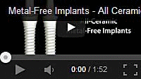 Video about ceramic dental implants